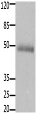 CCKBR Antibody