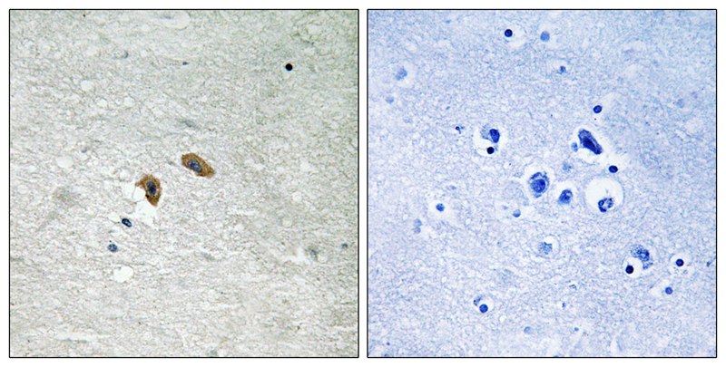 C-RAF (Phospho-Thr269) Antibod