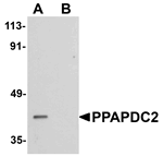 PPAPDC2 Antibody