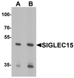 SIGLEC15 Antibody