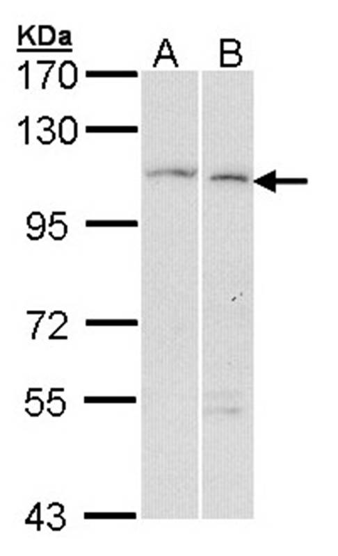 alpha Glucosidase II antibody