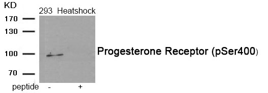 Progesterone Receptor (Phospho