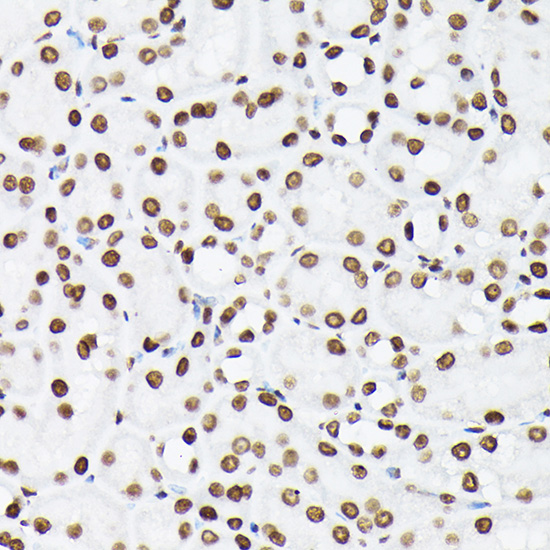 Histone H3K9me2 Polyclonal Ant