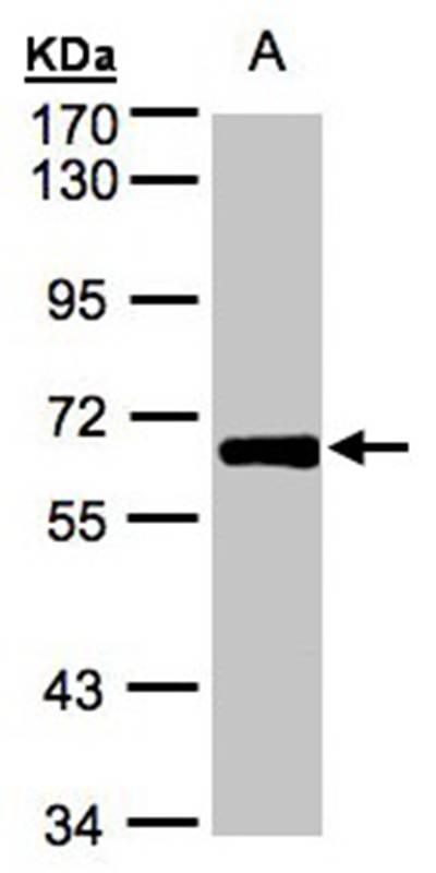 ZNF169 antibody