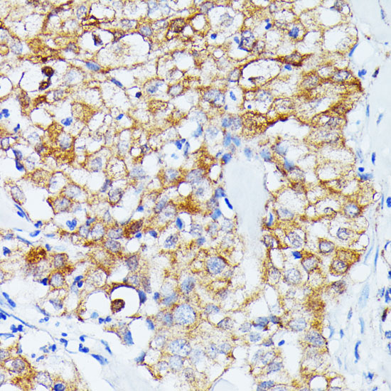 ECE1 Antibody