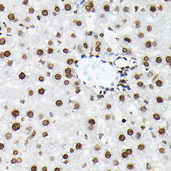 Histone H3K9me2 Polyclonal Ant