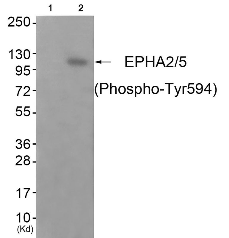 EPHA2/5 (Phospho-Tyr594) Antib