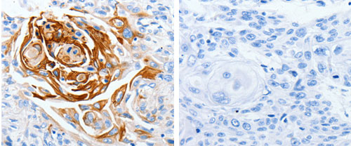 LPAR4 Antibody