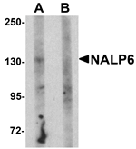 NALP6 Antibody