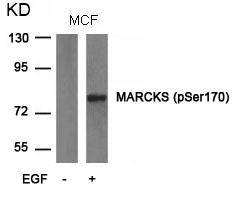 MARCKS(phospho-Ser170) Antibod