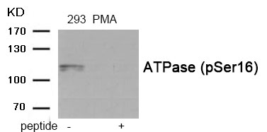 ATPase (Phospho-Ser16) Antibod