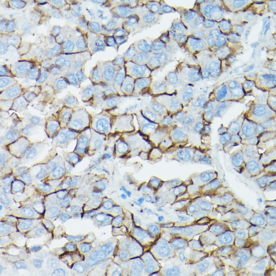 CTNND1 Antibody