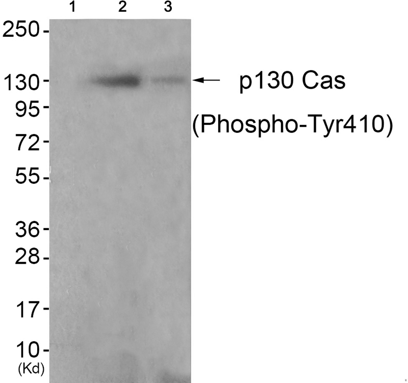 p130 Cas (Phospho-Tyr410) Anti