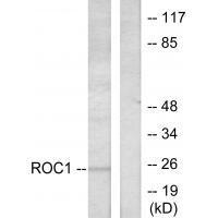 RIT1 Antibody