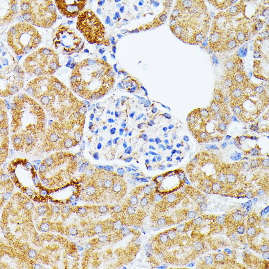 ECE1 Antibody