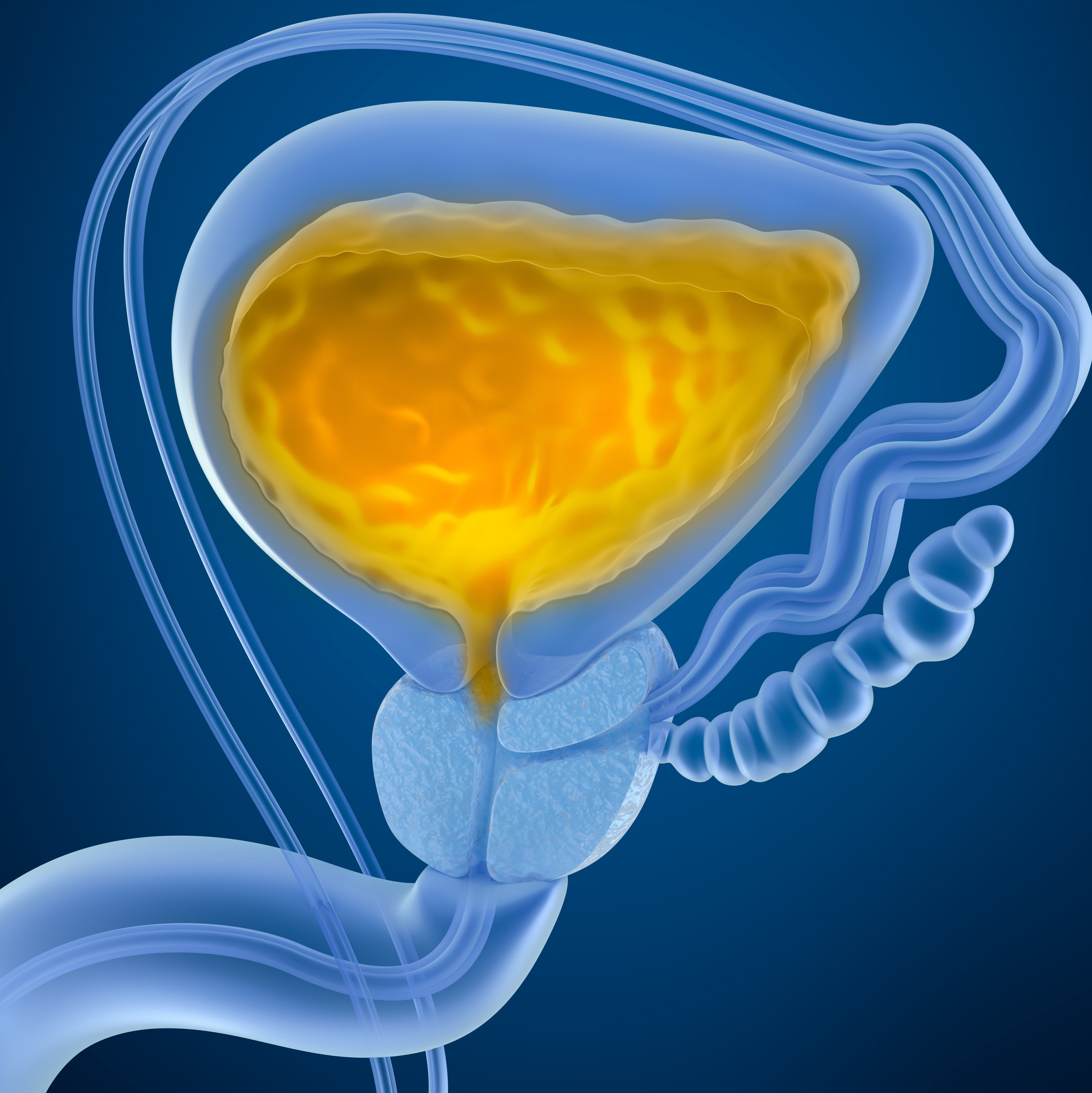 外泌体提取试剂盒(尿液)