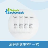 Soluble Guanylyl Cyclase alpha 1抗体 | Anti-Soluble Guanylyl Cyclase alpha 1 Polyclonal Antibody