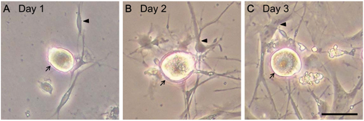 DRG培养物的细胞形态学特征