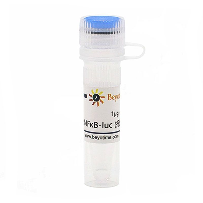 pNFκB-luc (报告基因质粒)
