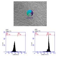 人脐带间充质干细胞