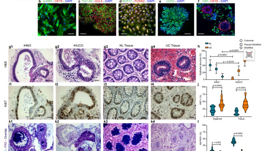 结肠炎模型构建全攻略