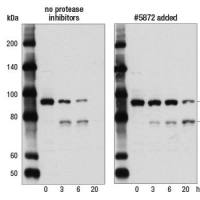 Cell Signaling CST 生化试剂 5872S Protease