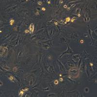 浙江(杭州)美森永生化大鼠原代膝关节滑膜成纤维细胞