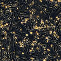 浙江（杭州）美森人脑胶质母细胞瘤细胞DBTRG05MG