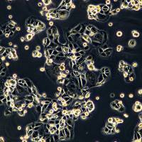 浙江（杭州）美森非小细胞肺癌腺癌细胞 NCI-H2085