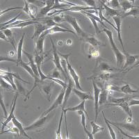 浙江(杭州)美森人脑多形性胶质母细胞瘤细胞 BT325