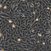 浙江(杭州)美森人脑胶质母细胞瘤细胞 LN18