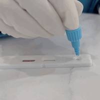 嗜吞 噬细胞无形体IgG抗体检测试剂盒「间接荧光IFA」