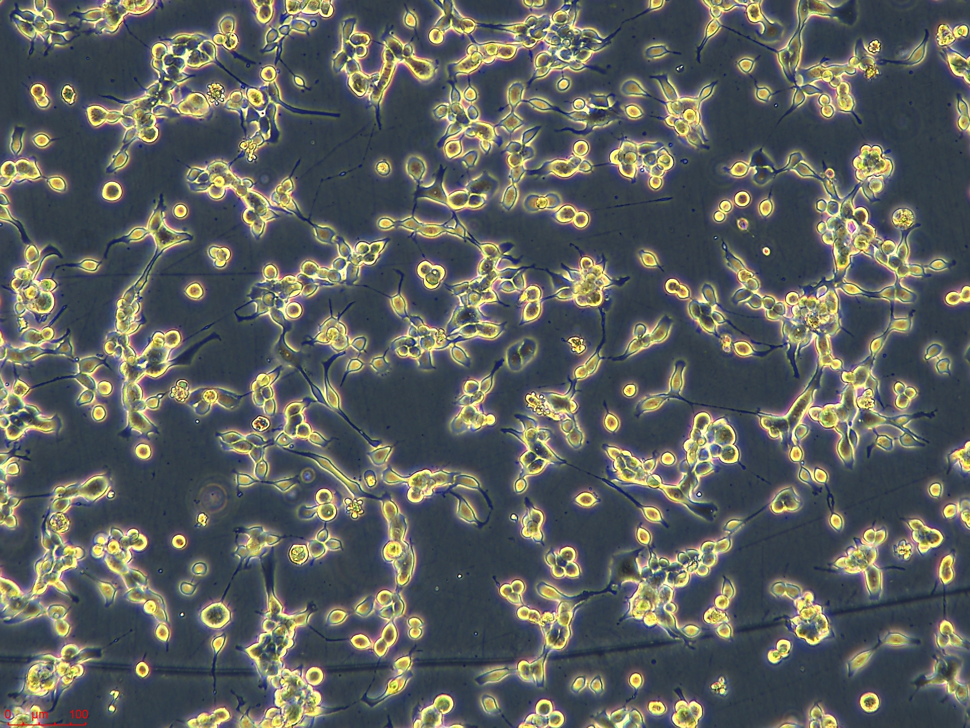 【每日推荐】浙江（杭州）美森细胞-乳腺癌细胞MFM-223