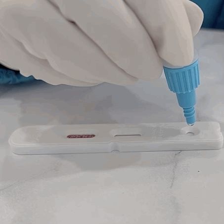 肺吸虫lgM 抗体检测试剂盒(ELISA)