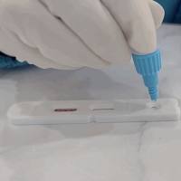 肺吸虫lgM 抗体检测试剂盒（ELISA）