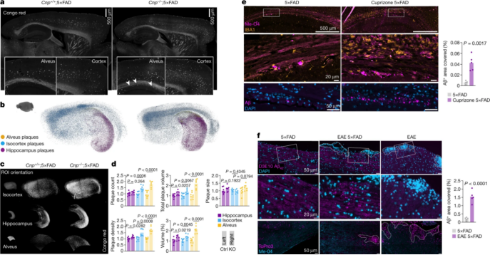 Nature  |  组织透明化三维成像揭示AD发病重要因素