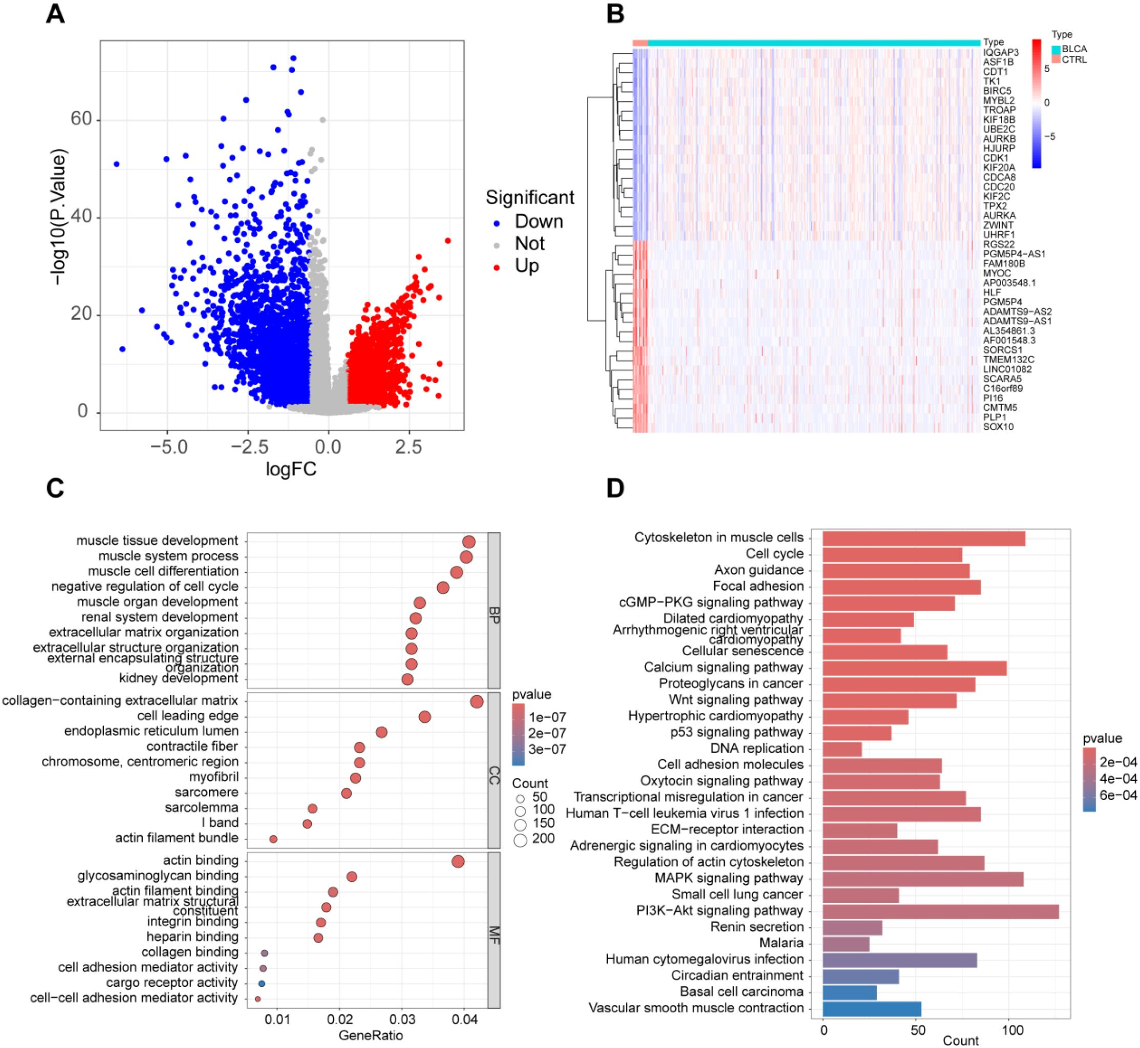 IF:5.9单细胞+乳酸化+机器学习,赋能锁定膀胱癌“代谢-乳酸化”双靶点FASN/RUNX2!