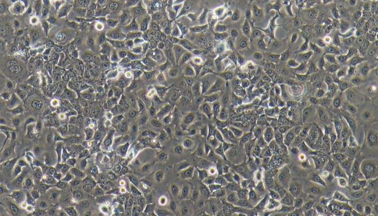 永生化细胞构建方法 || 山羊乳腺上皮细胞永生化构建方法