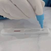 包虫病IgG抗体检测试剂盒(酶联免疫法)说明书