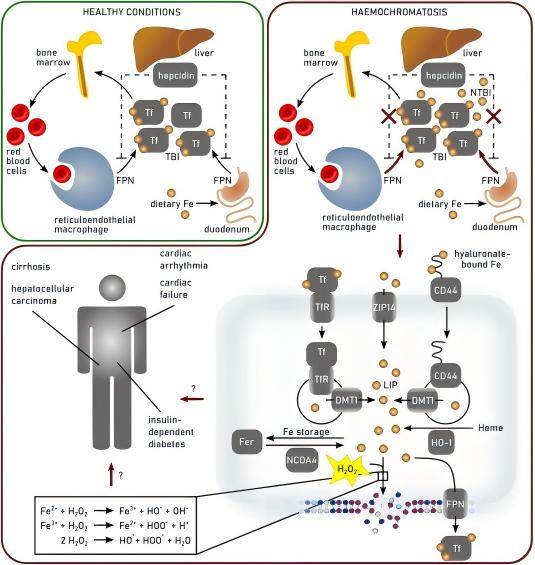IF:10.6，单细胞转录组+铁死亡+衰老+多酚纳米技术！