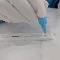 管圆线虫IgM抗体检测试剂盒 说明书