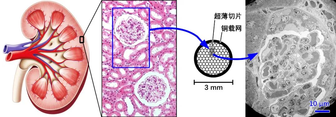 为什么生物透射电镜实验的“模型组”建议送检复样？