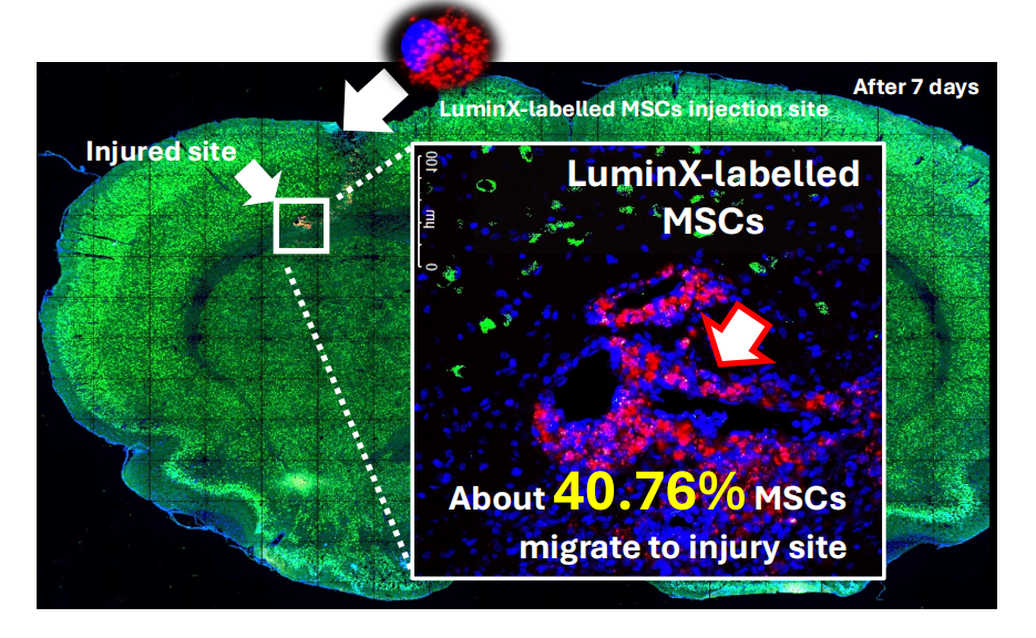 从看见到证明：LuminX 镁迪生医 助力脑损伤细胞治疗快速验证