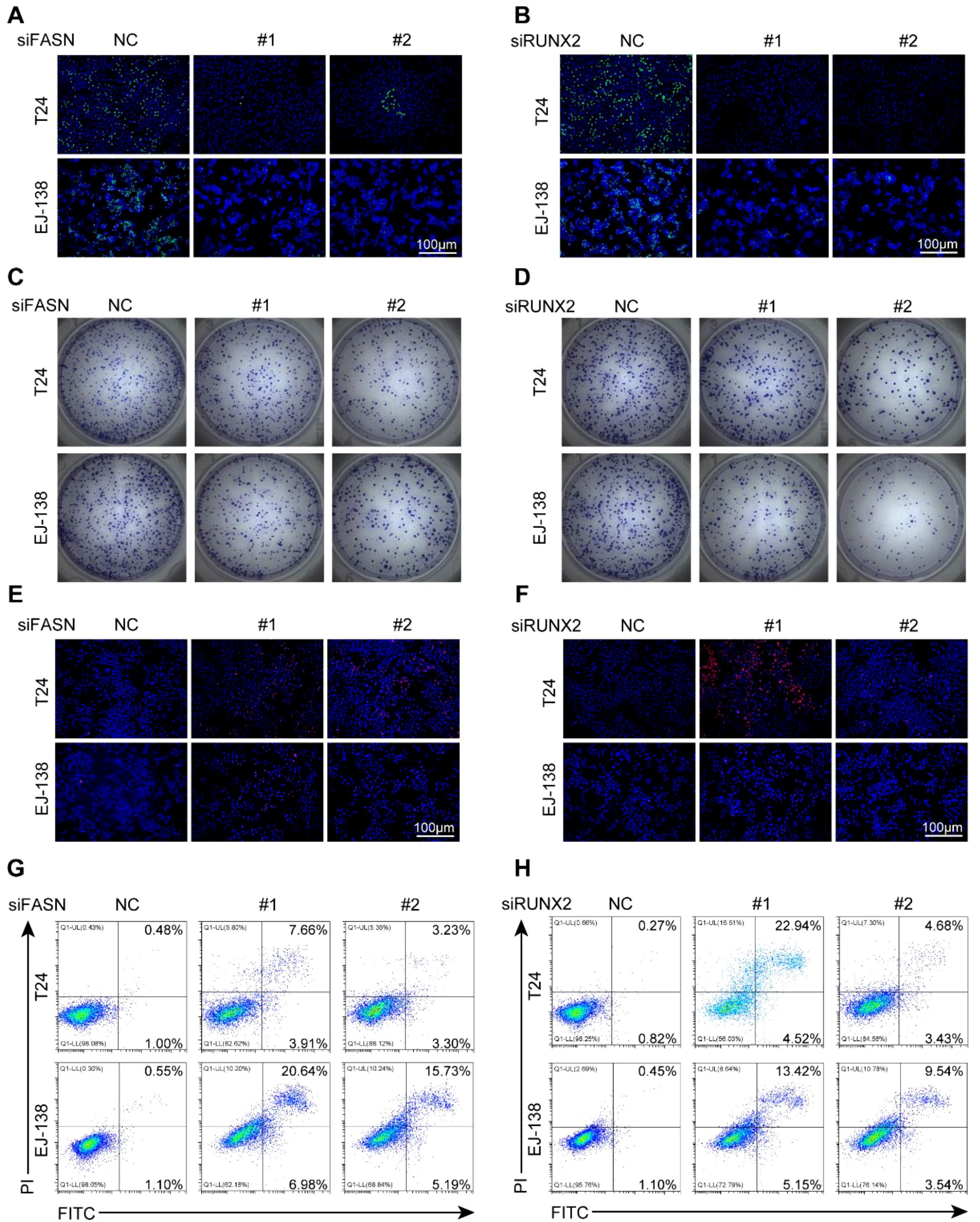 IF:5.9单细胞+乳酸化+机器学习,赋能锁定膀胱癌“代谢-乳酸化”双靶点FASN/RUNX2!