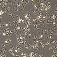 浙江(杭州)美森 人肝星形细胞LX2(Luc1)现货