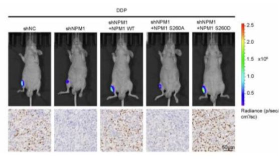 【IF 52.7】突破骨肉瘤顺铂耐药研究瓶颈，IHC试剂盒助力关键发现