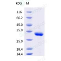 Recombinant SARS-CoV Spike/RBD Protein (RBD, His Tag) | 重组非典型肺炎病毒 (SARS) Spike/RBD 蛋白 (RBD, His标签)