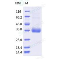 MERS-CoV Spike/RBD Protein fragment (RBD, aa 367-606, His Tag)