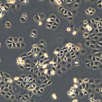 浙江（杭州）美森 人食管鳞癌细胞 KYSE30