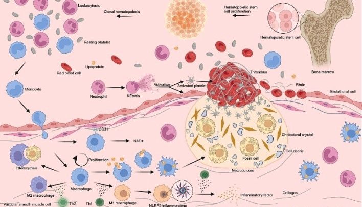 动脉粥样硬化研究的核心机制，你了解多少？